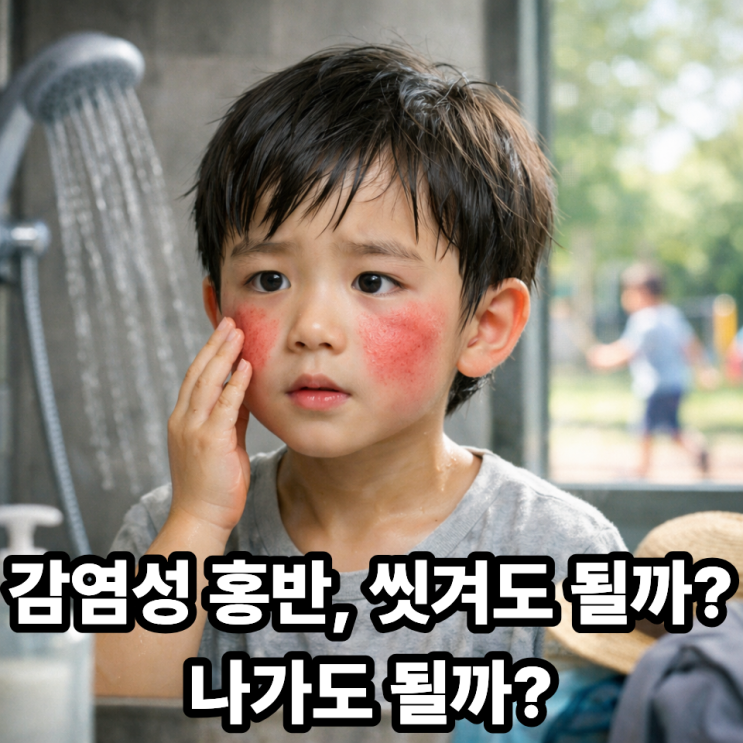   감염성 홍반일 때 목욕·외출, 해도 될까? 꼭 지켜야 할 기준