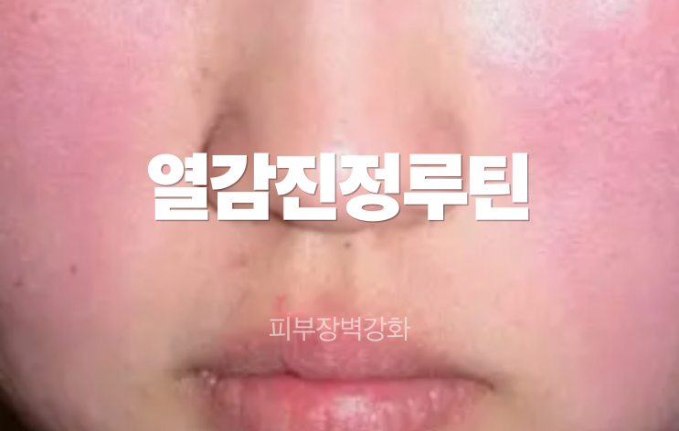  홍조 피부 항산화 루틴 환절기 열감 줄여준 저녁 관리 꿀팁 (2026)