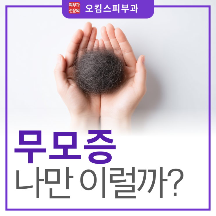  일산 모발이식 피부과 무모증여자 남자, 나만 이런 걸까?