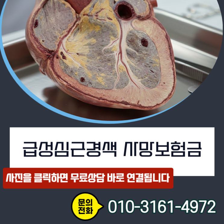  급성심근경색 사망보험금, 부검 안해도 지급받는 손해사정 실무 비결