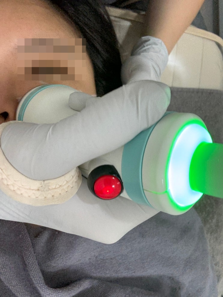  부산 서면 온다리프팅 내돈내산 후기ㅣ 통증 전후 효과