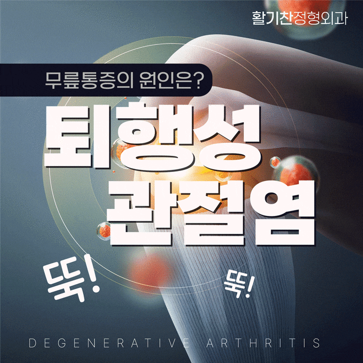  구파발무릎통증, 초기증상부터 관절염 늦추는 법