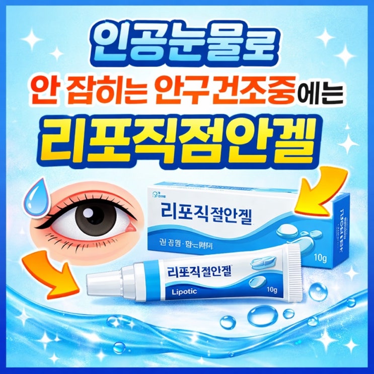  인공눈물로 안 잡히는 안구건조증에는 리포직점안겔