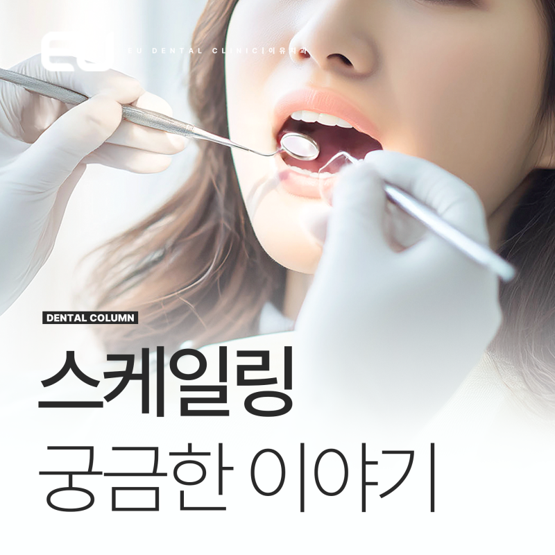 스케일링 비용 소요시간 6개월주기 식사시간