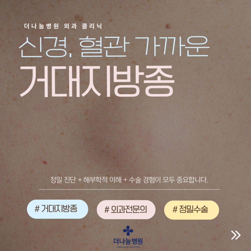 인천 인하대역 거대지방종, 7년된 지방종 외과전문의의 섬세한 집도가 필요