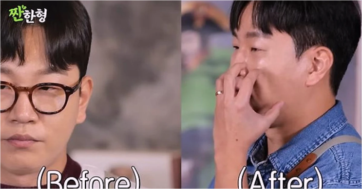  정호철 성형 고백 진실! 눈밑 지방 제거 수술 후 문채원 반응은?