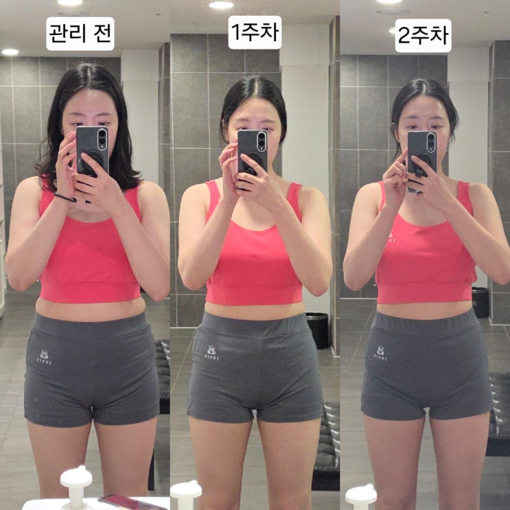 30대 동탄 다이어트 병원 헬스장 말고 선택한 쥬비스 앞자리 바뀐 후기
