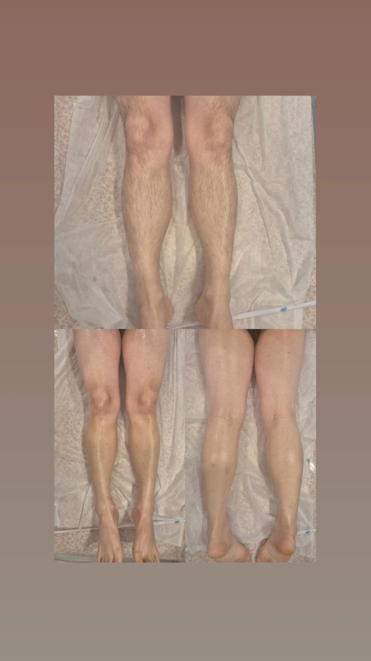  남자 다리 왁싱은 남자 왁서 두 명이 동시에 투입되는 영등포 남자 왁싱샵 "청춘케어"