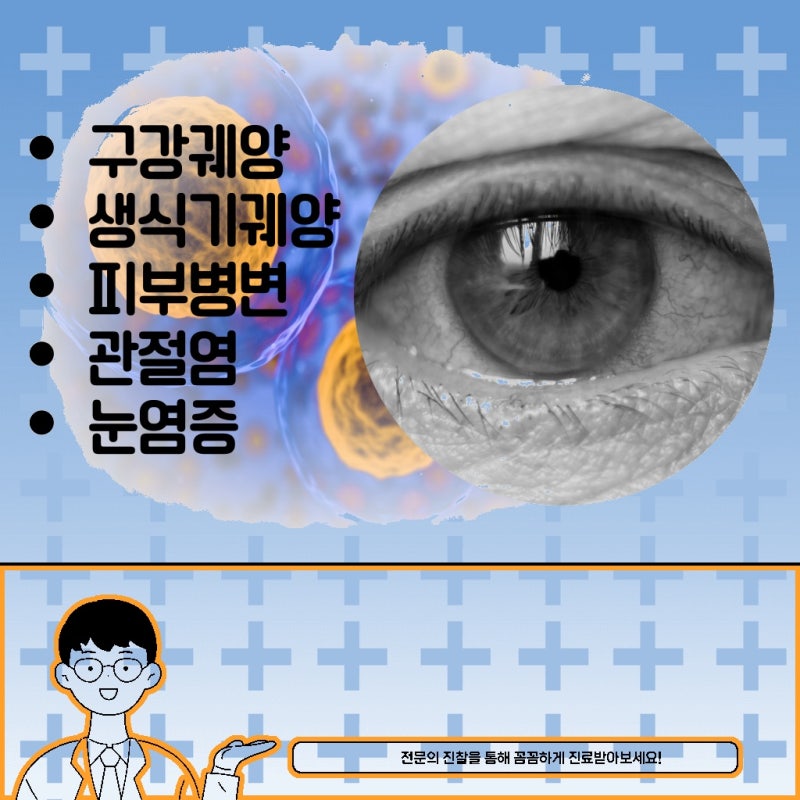 자가면역질환 완치보다 중요한 것은 꾸준한 관리