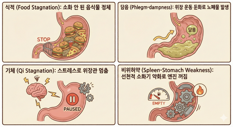 물만 마셔도 배가 빵빵해요, 지긋지긋한 [복부팽만감]의 원인과 해결법