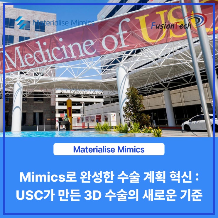  [Materialise S/W] Mimics로 완성한 수술 계획 혁신 : USC가 만든 3D 수술의 새로운 기준