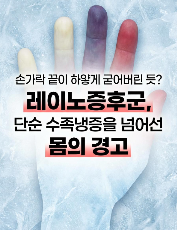 손가락 끝이 하얗게 변한다면?레이노증후군, 단순 수족냉증을 넘어선 몸의 신호