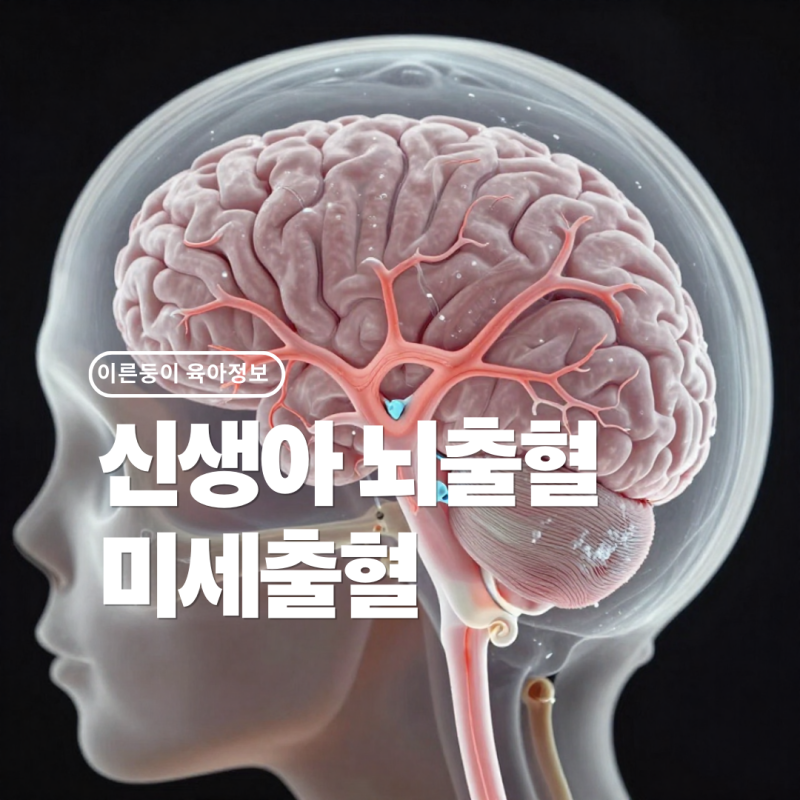 신생아 뇌출혈, 이른둥이 NICU에서 발견된 미세출혈 경험 기록