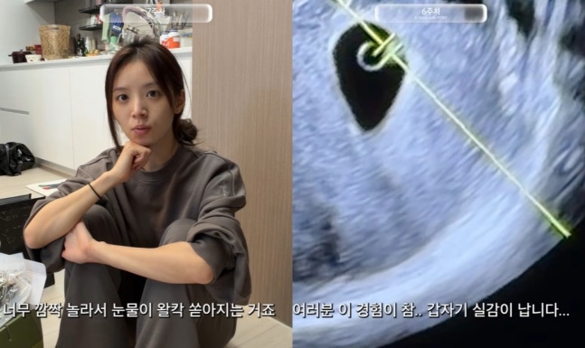  ‘하트시그널4’ 김지영 임신 중 낙상 사고 고백… “나는 괜찮아도 아이만 무사하길” 눈물의 순간️