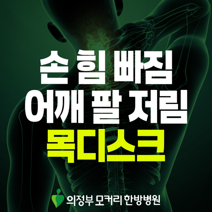  가능역 목디스크 증상, 단순한 뻐근함과는 다른 이유