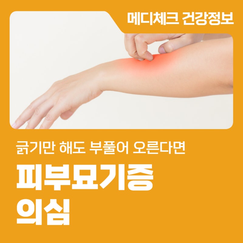 긁기만 해도 부풀어 오른다면 피부묘기증 의심