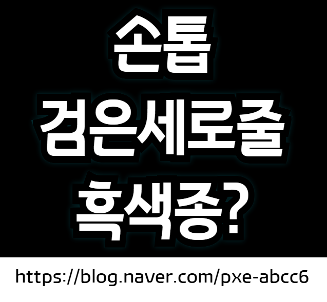 손톱 검은세로줄 흑색종 원인과 치료 방법 (검은세로줄 이유와 없애는 방법)