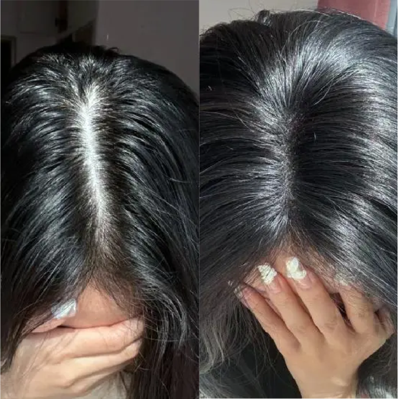 채정안 두피앰플 쓰고나서