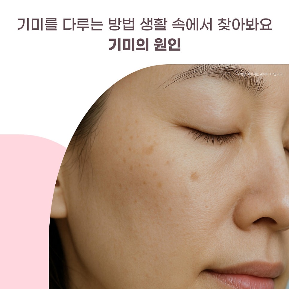 기미를 다루는 방법 생활 속에서 찾아봐요 대표 이미지