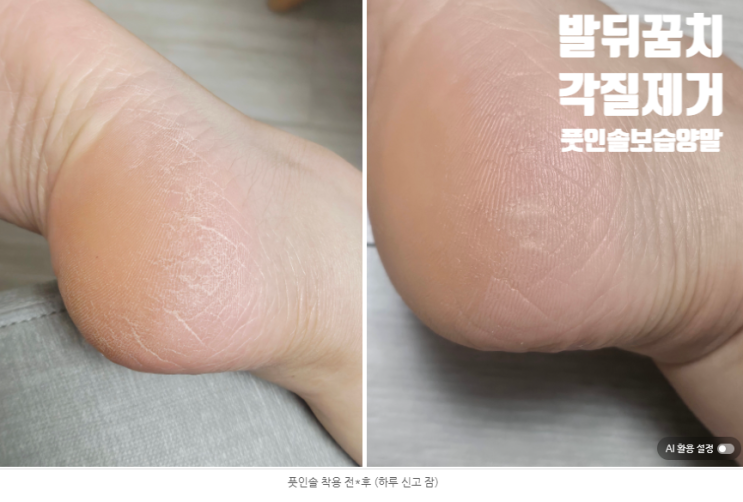  발각질 관리 귀찮은 사람 필독, 신기만 하면 끝나는 풋인솔 보습양말
