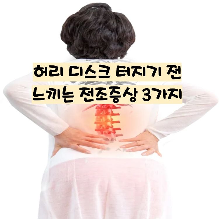 아침에 세수하다 헉? 허리 디스크 터지기 전 느끼는 전조증상 3가지