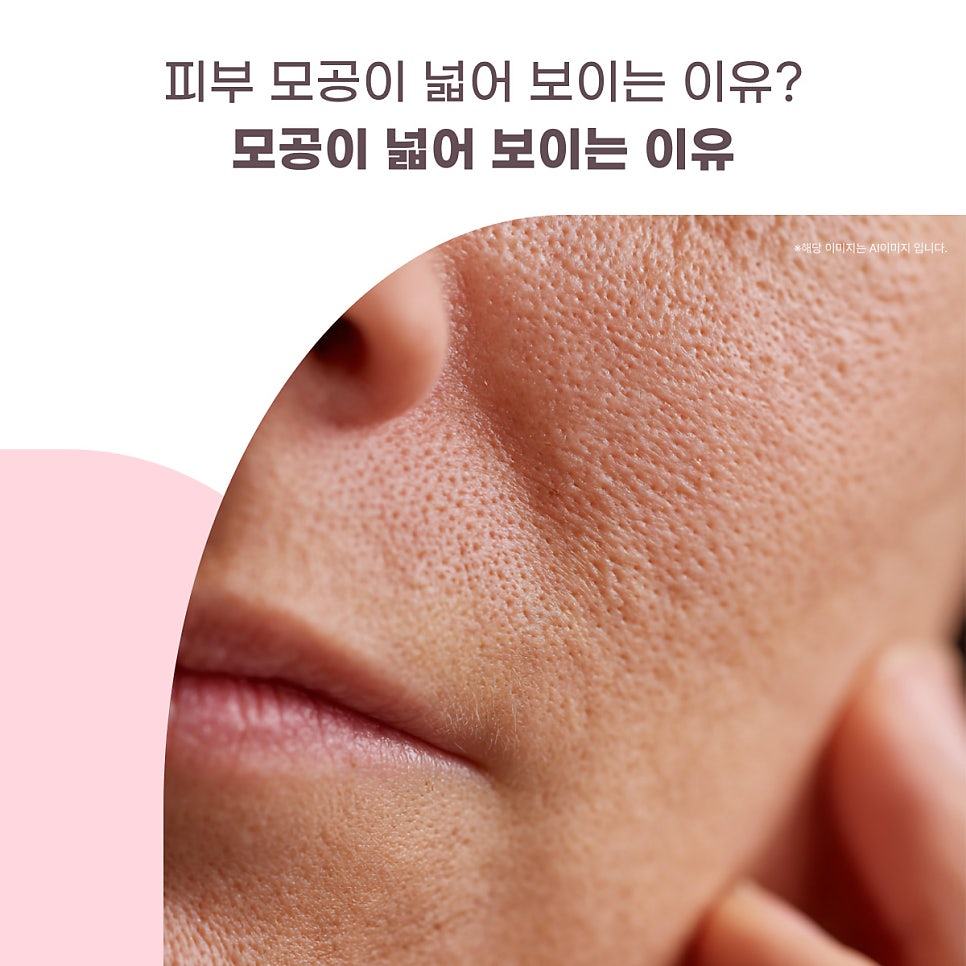 모공이 넓어 보이는 이유 대표 이미지