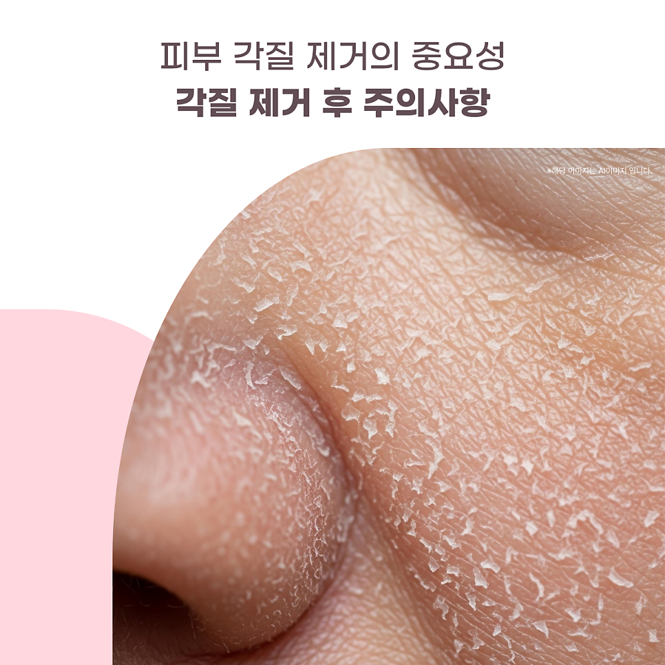 피부 각질 제거의 중요성 대표 이미지