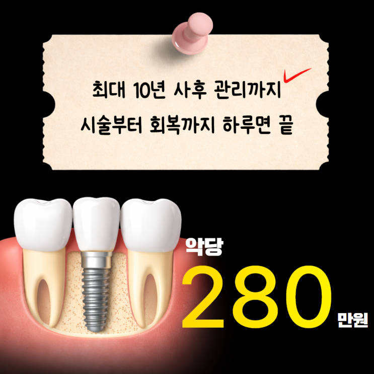  임플란트 비용때문에 미루고 계신 분들 보세요!
