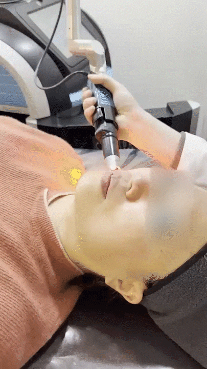  강남 피부과 피코슈어토닝레이저 시술, 기미·흑자 고민 끝!