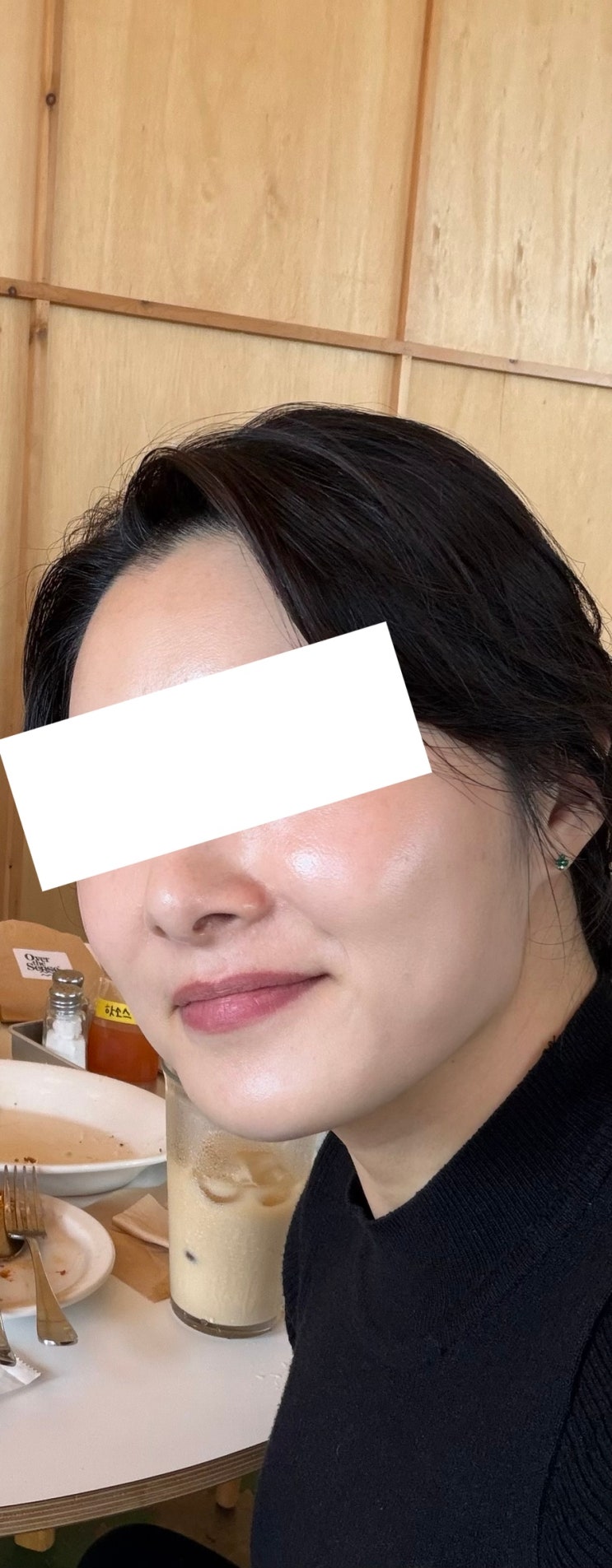  스킨부스터 엘라비에 리투오 1차 한달 경과 후기