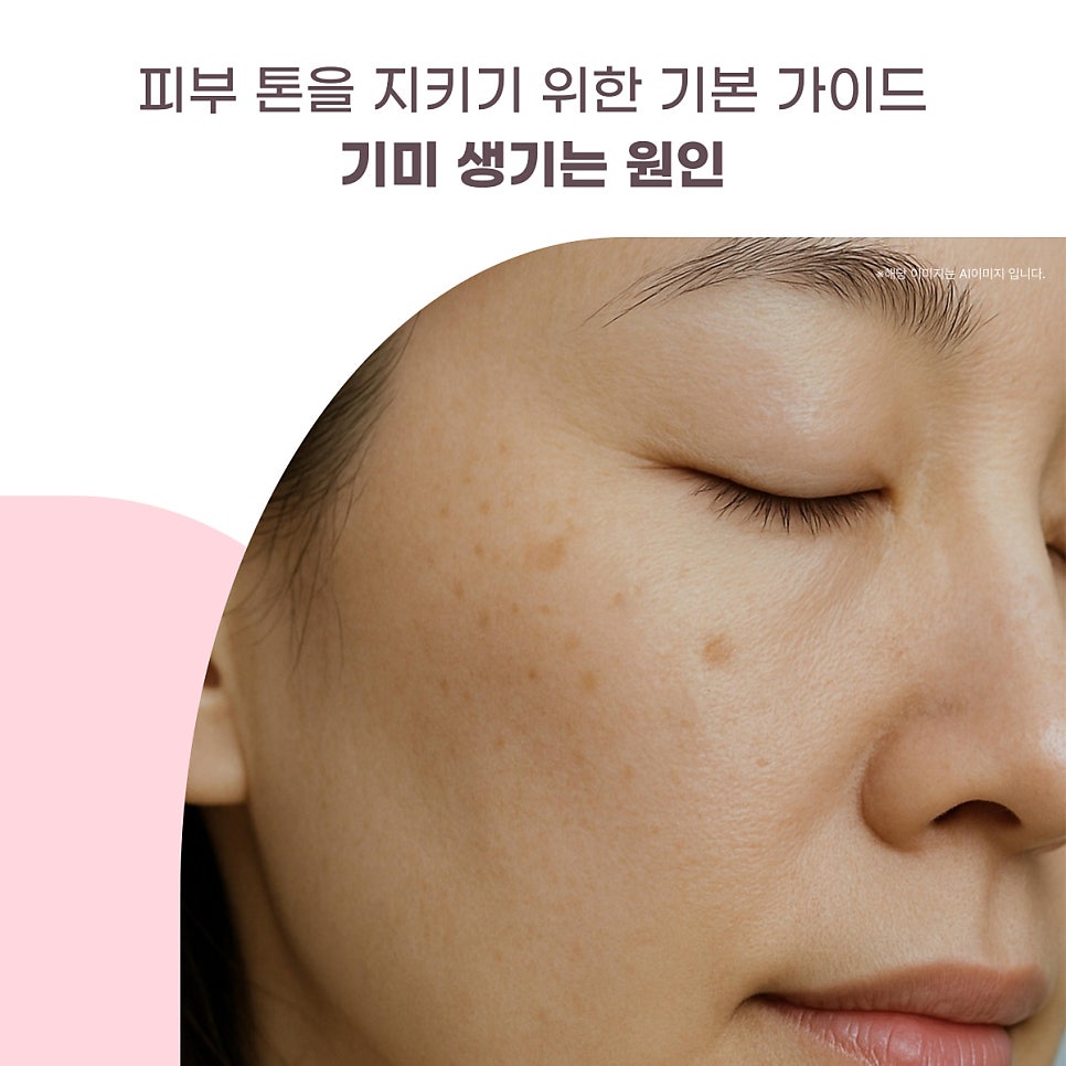 기미 생기는 원인과 관리방법 : 피부 톤을 지키기는 기본 가이드 대표 이미지
