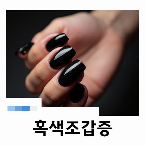 손톱이 검게 변했다면 그냥 넘기지 마세요 흑색조갑증