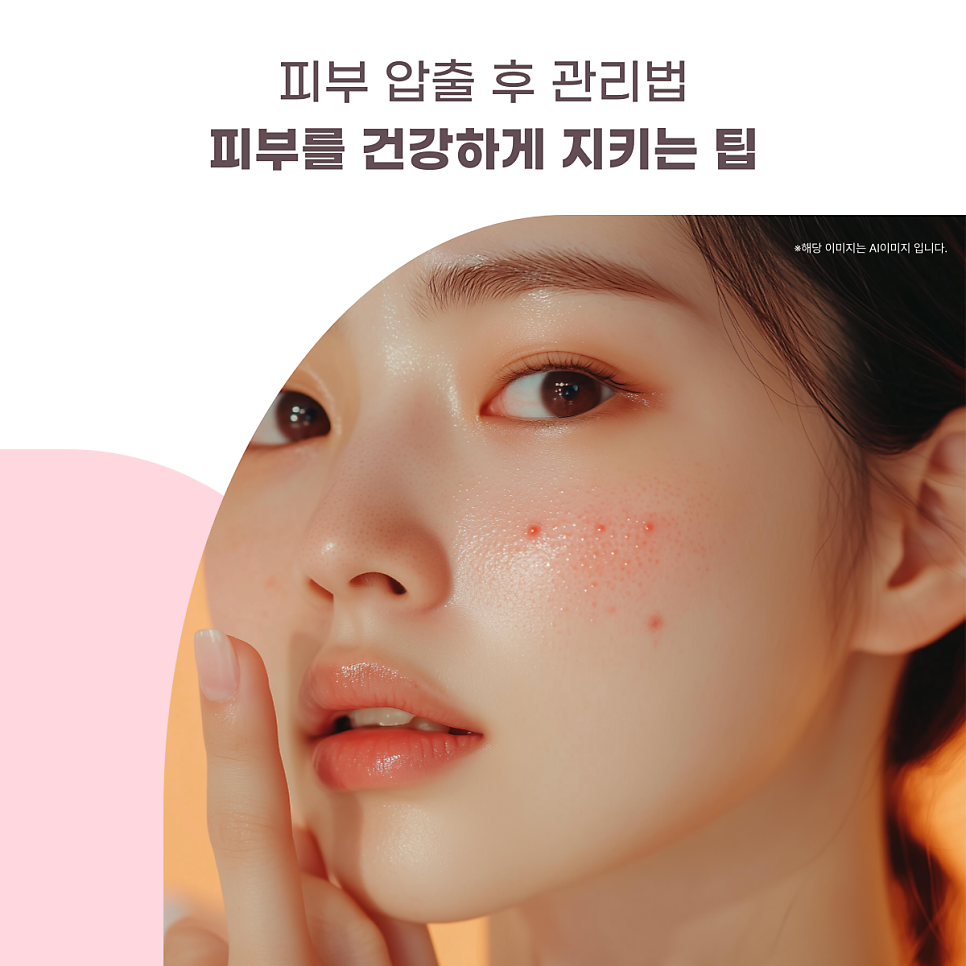 피부 압출 후 관리법 - 피부를 건강하게 지키는 팁 대표 이미지
