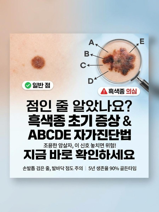 점인 줄 알았나요? 피부암 흑색종 초기 증상과 ABCDE 자가진단법 총정리