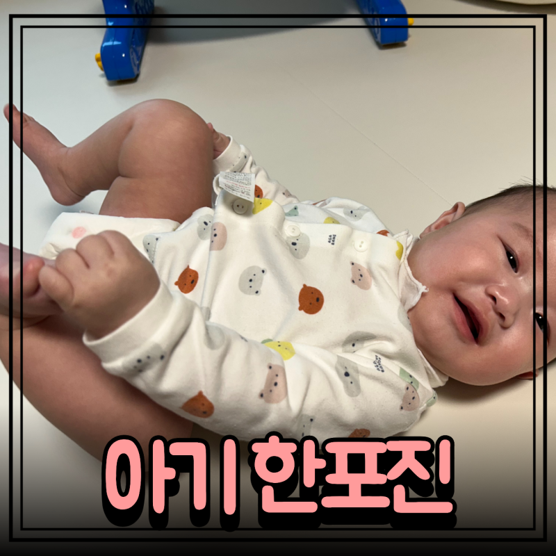 아기 한포진 원인 증상 치료법 유아 수족구와 차이점