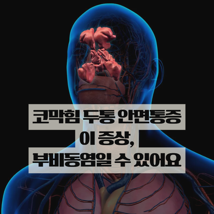  코막힘 두통 계속된다면? 부비동염 증상 꼭 확인하세요