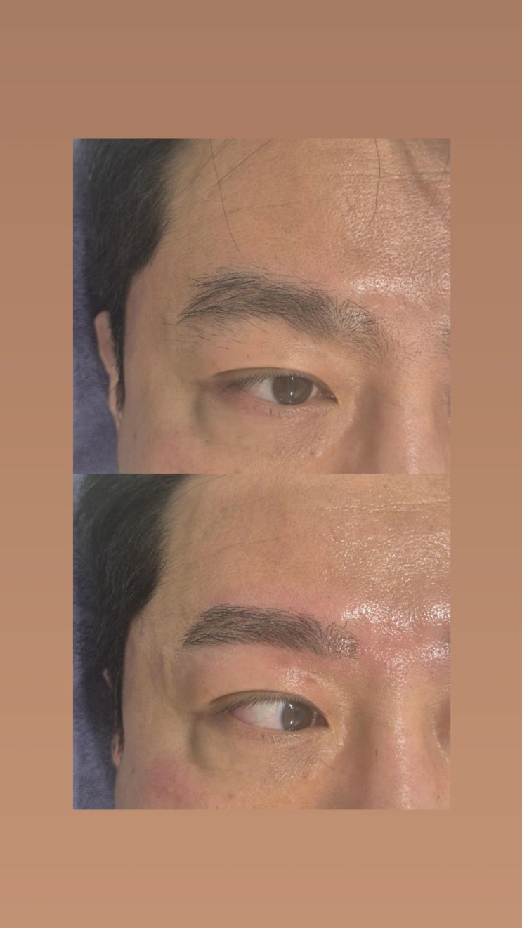  더 선명하고 더 깔끔하게, 남자 눈썹 왁싱은 영등포 남자 왁싱샵 "청춘케어"