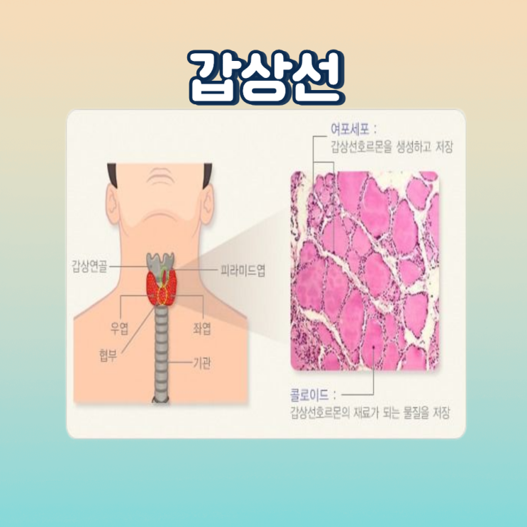  청주 갑상선 이상 신호를 놓치지 마세요