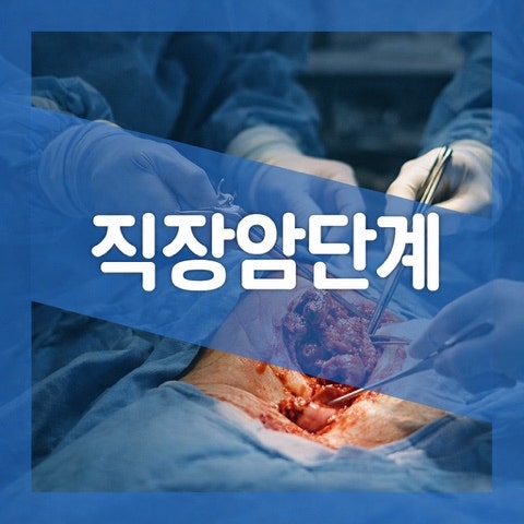 직장암 생존율 1기 2기 3기 4기 차이, 검사 수술 치료 비교