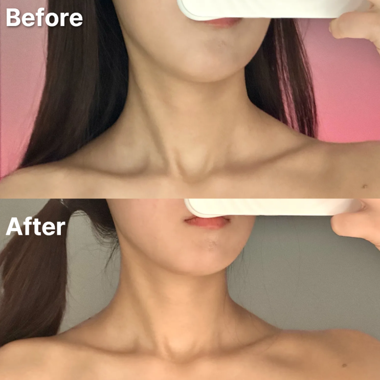  마곡 승모근관리 신부관리 등 후기 스완드에스테틱 발산점 추천