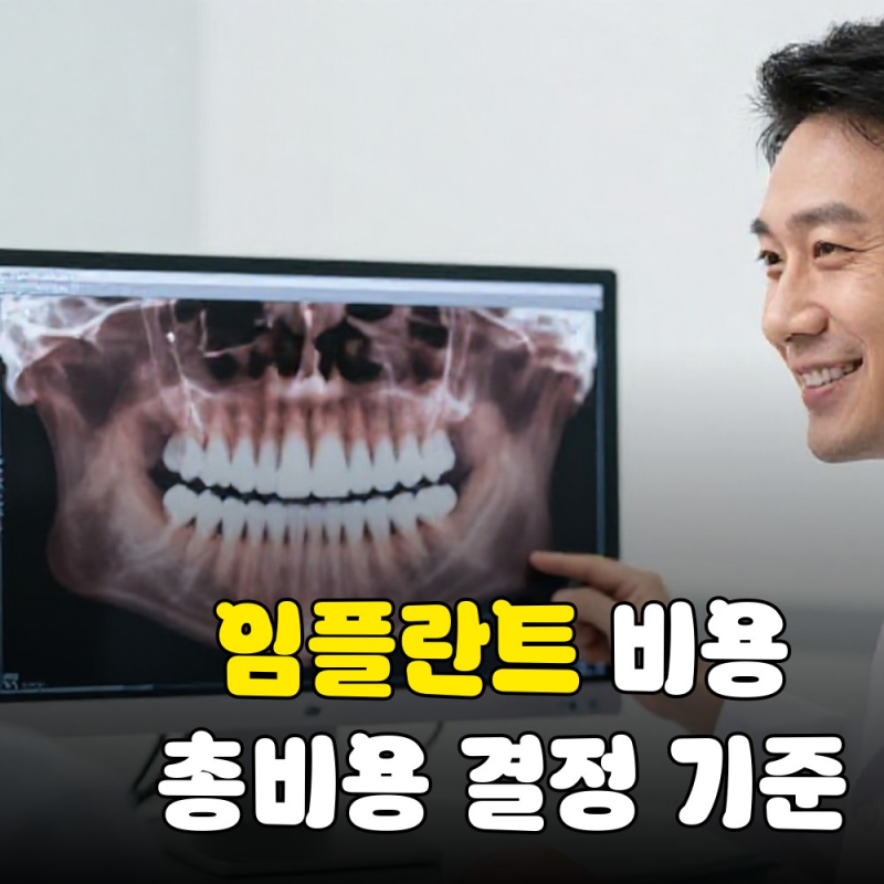 임플란트 가격비교: 기준, 비용부터 보험, 브랜드까지 총정리