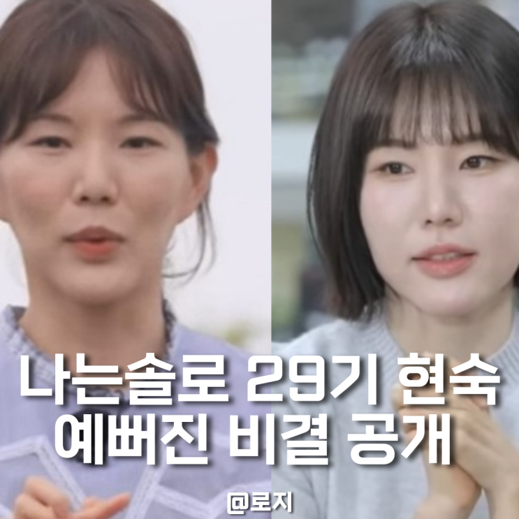  나는솔로 29기 현숙 미모 급상승 이유 공개! 보톡스 필러 솔직 고백