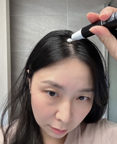 옥주현 탈모템 여성탈모 극복 후기