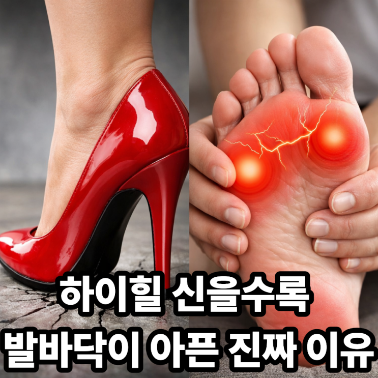  하이힐·딱딱한 구두가 발바닥 통증을 만드는 이유와 대처법