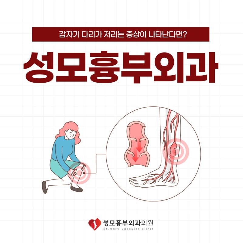 청주하지정맥류 다리에서 통증이 느껴진다면
