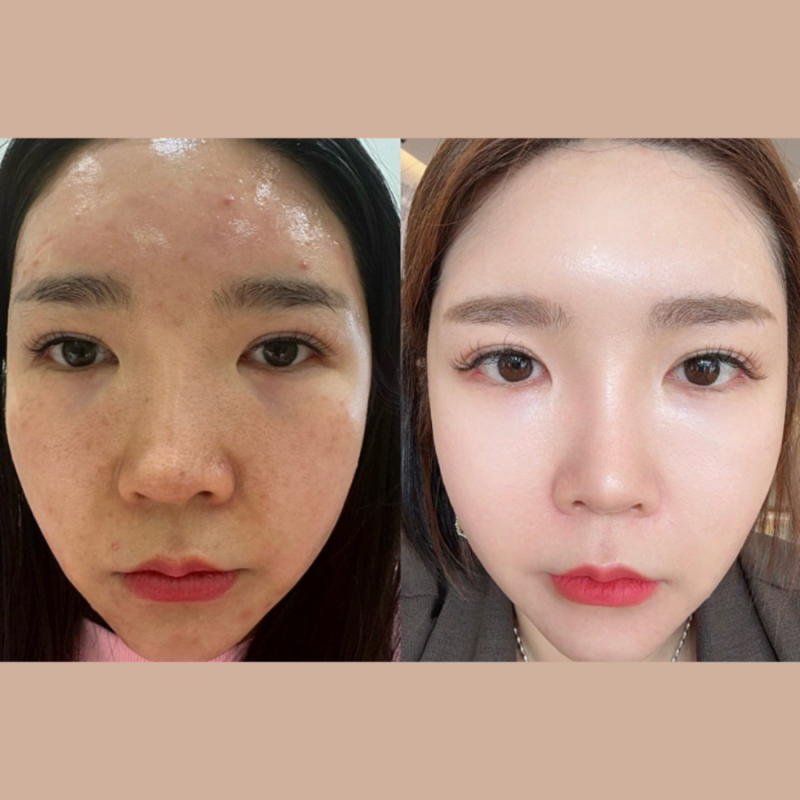 자외선 차단과 항산화를 한 번에? 인셀덤 선크림+비비 3:1 꿀조합으로 '맞선 프리패스' 피부 ....