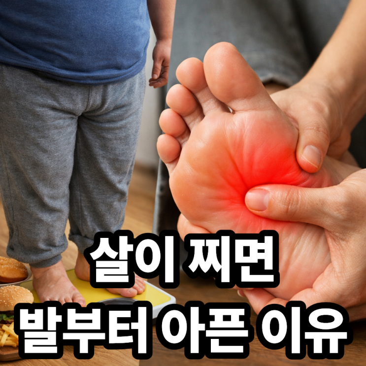  발바닥 통증과 체중 증가의 관계｜살이 찌면 발이 먼저 아픈 이유