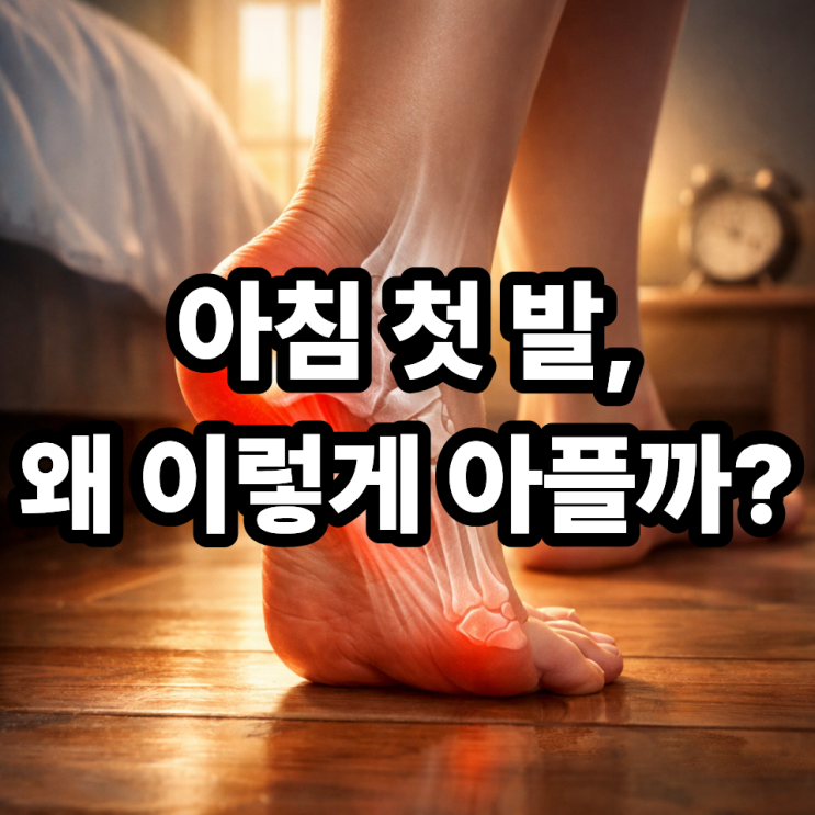  아침에 첫 발 디딜 때 발바닥 통증이 심한 이유｜족저근막염 신호일까?