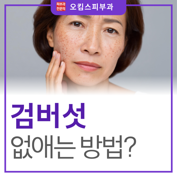  일산동구 마두동피부과 얼굴 검버섯없애는법, 거뭇거뭇 한 얼룩 어떻게 없앨 수 있을까?