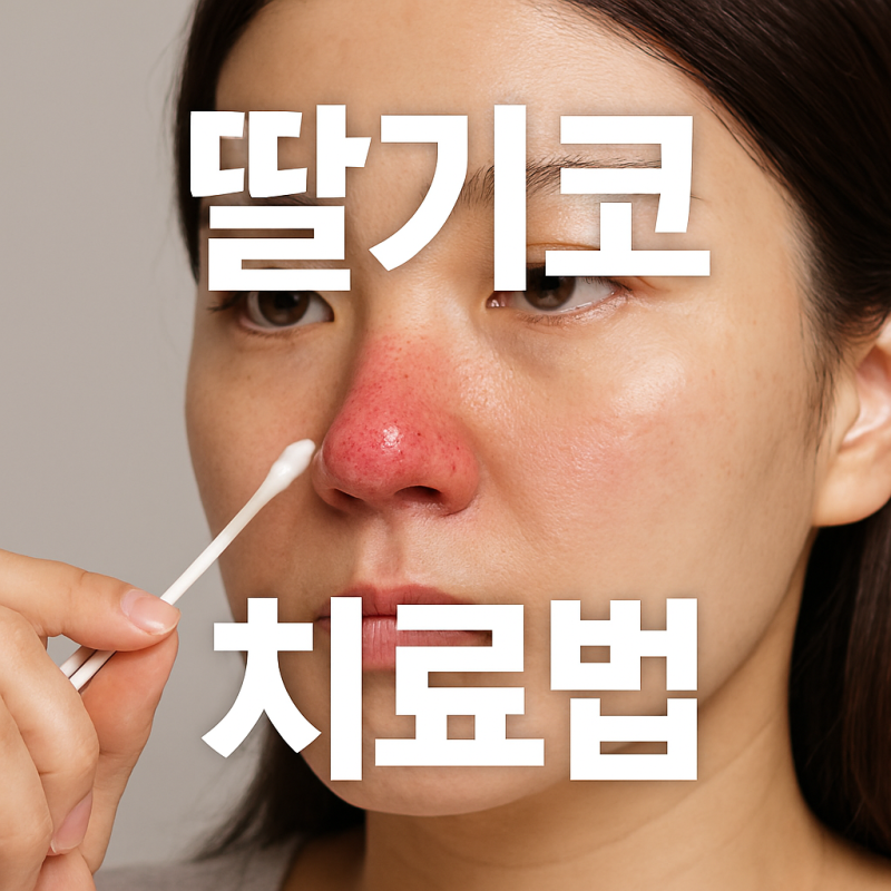 딸기코치료법, 병원 말고 생활습관으로 관리하는 방법
